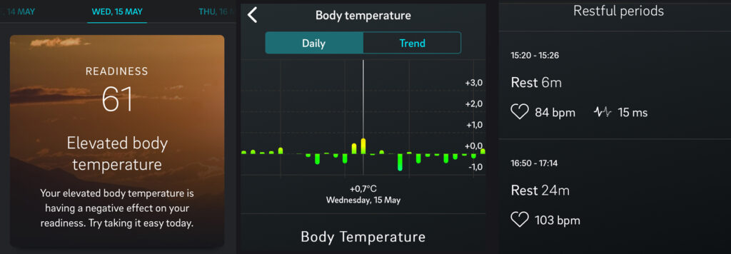 Oura ring body temperature 